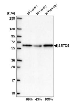SETD5 Antibody, Novus Biologicals:Antibodies:Primary Antibodies